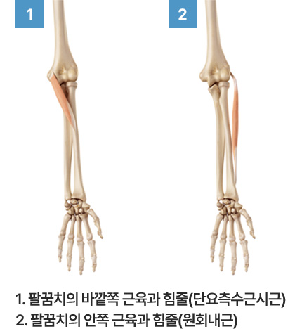 1. 팔꿈치의 바깥쪽 근육과 힘줄(단요측수근시근) 2. 팔꿈치의 안쪽 근육과 힘줄(원회내근)