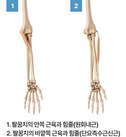 1. 팔꿈치의 안쪽 근육과 힘줄(원회내근) 2. 팔꿈치의 바깥쪽 근육과 힘줄(단요측수근신근)