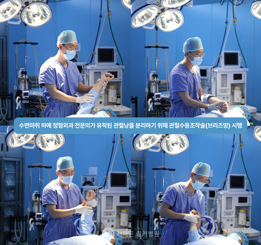 수면마취 하에 정형외과 전문의가 유착된 관절낭을 분리하기 위해 관절수동조작술(브리즈망) 시행