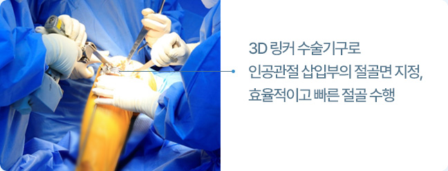 3D 링커 수술기구로 인공관절 삽입부의 절골면 지정, 효율적이고 빠른 절골 수행